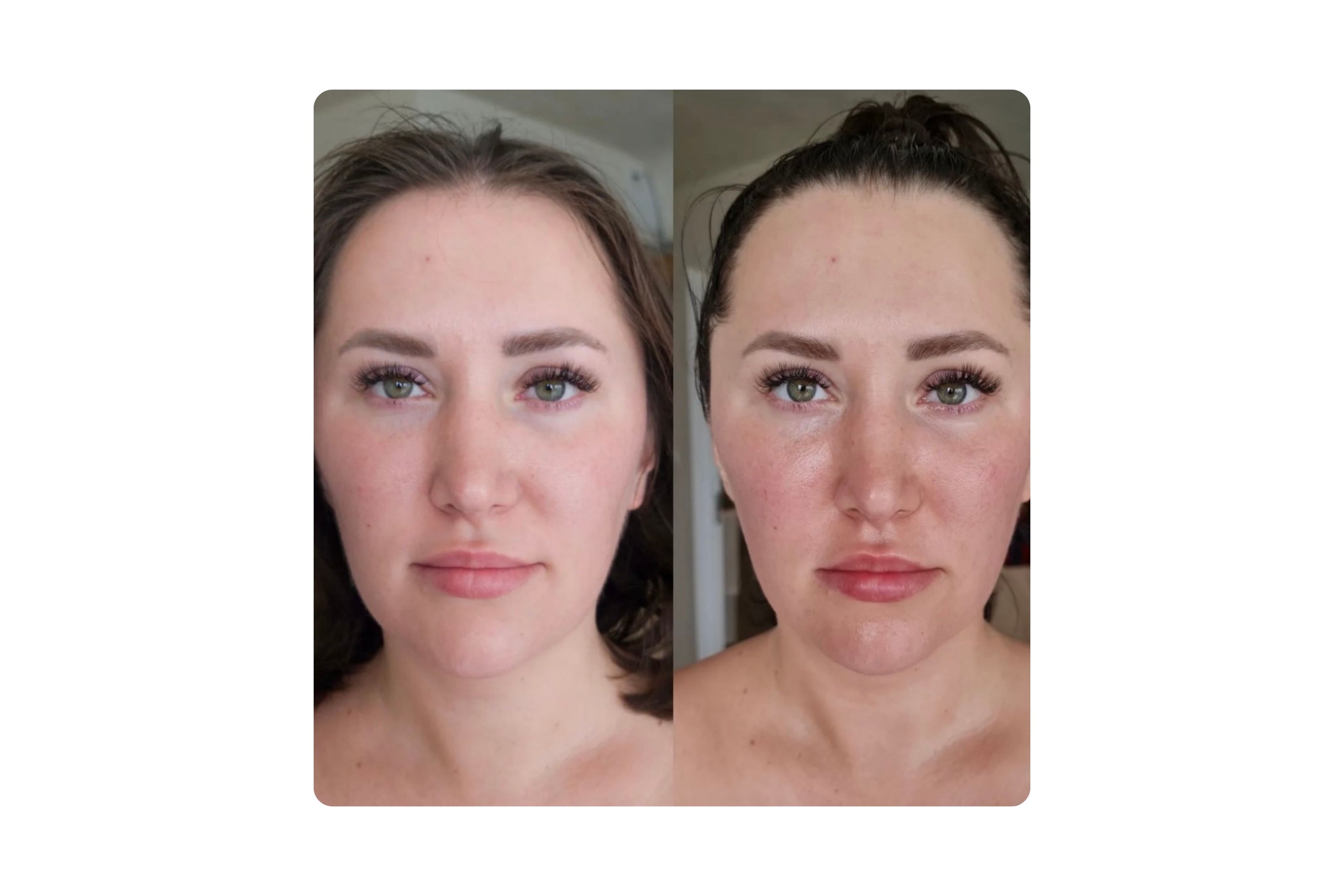 rebloom before after /  rebloom trước sau