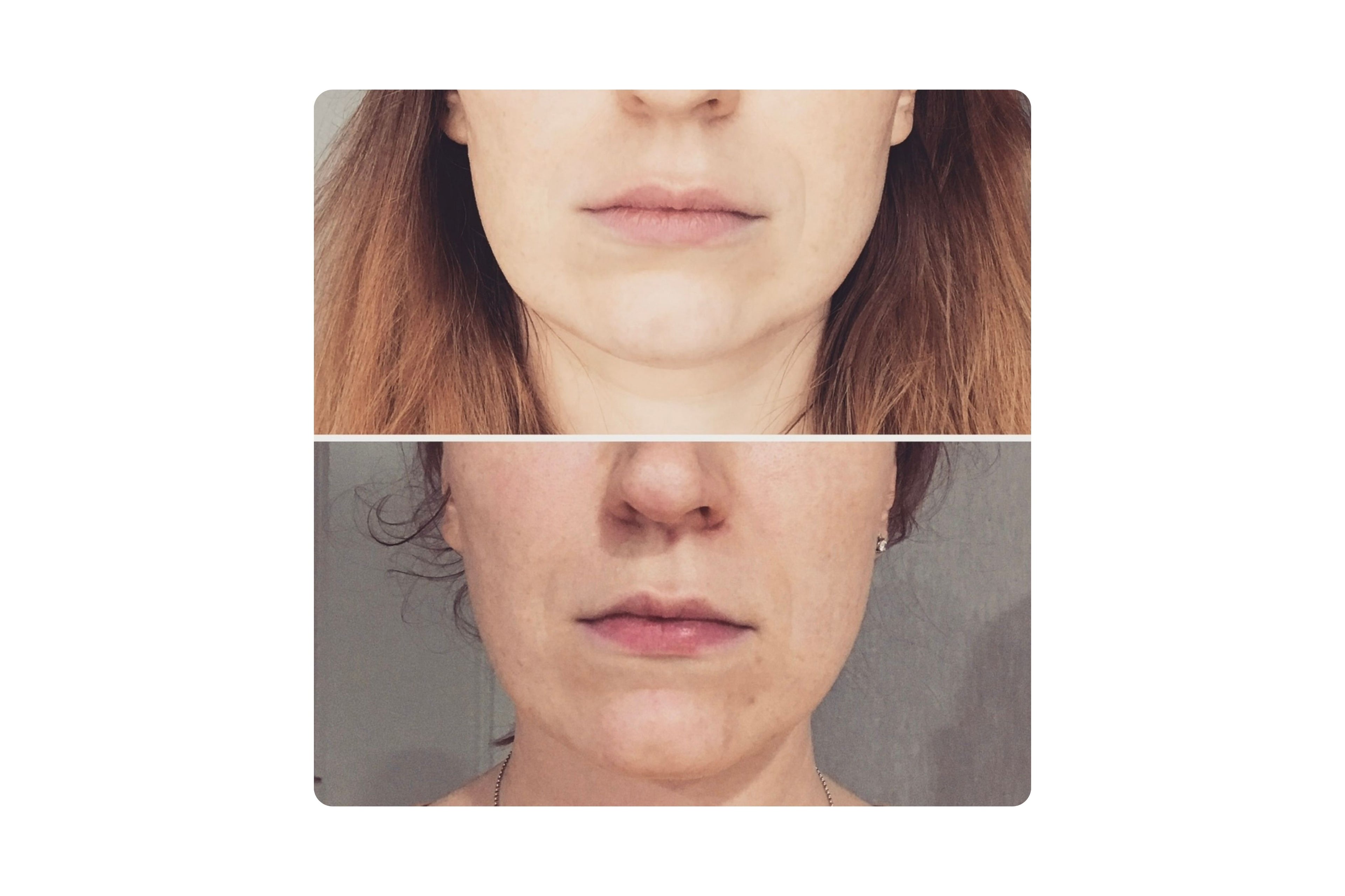 rebloom before after /  rebloom trước sau