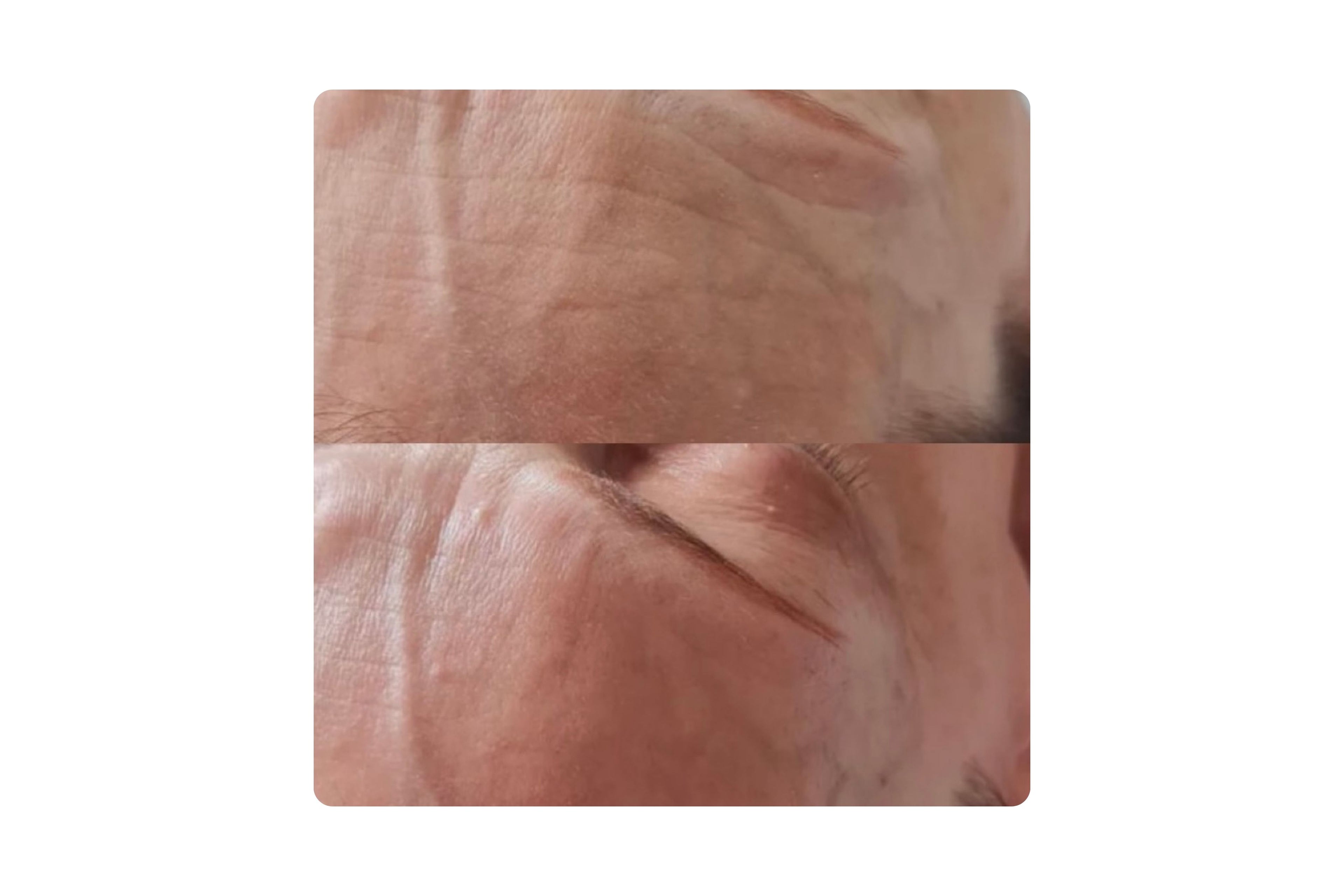 rebloom before after /  rebloom trước sau